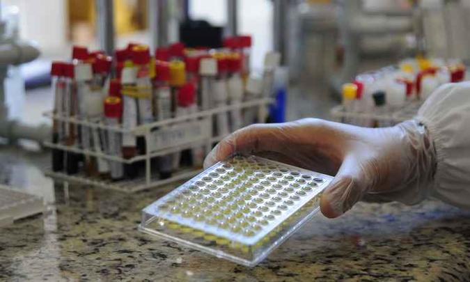 Testagem de sangue: especialista diz que não há exame 100% eficaz para detectar o vírus da Aids(foto: Gladyston Rodrigues/EM/D.A PRESS - 17/01/2018) Testagem de sangue: especialista diz que não há exame 100% eficaz para detectar o vírus da Aids(foto: Gladyston Rodrigues/EM/D.A PRESS - 17/01/2018)