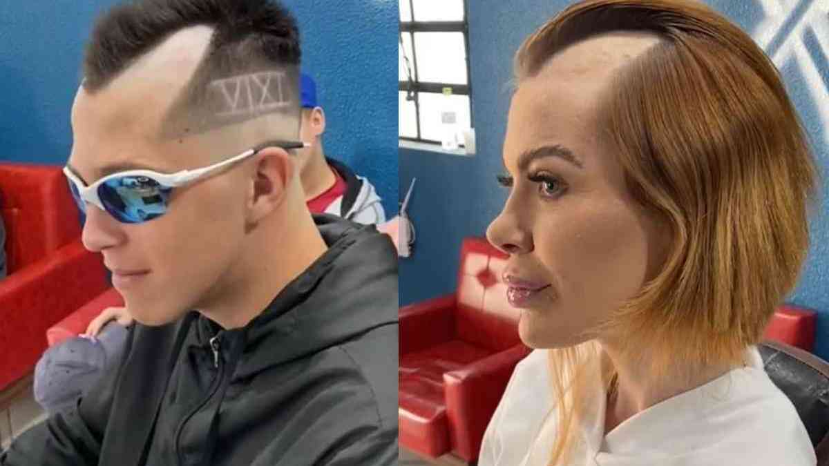 Corte de cabelo 'chavoso' em mulher choca por simular efeitos da calvície