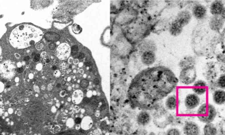 Clula do rim de macaco danificada aps infeco pela micron (esquerda) e visualizao da protena Spike na nova variante (direita)