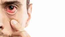 Olho seco no outono: saiba como aliviar os sintomas sem prejudicar a viso