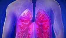 Agosto Branco: ms de conscientizao e preveno do cncer de pulmo 