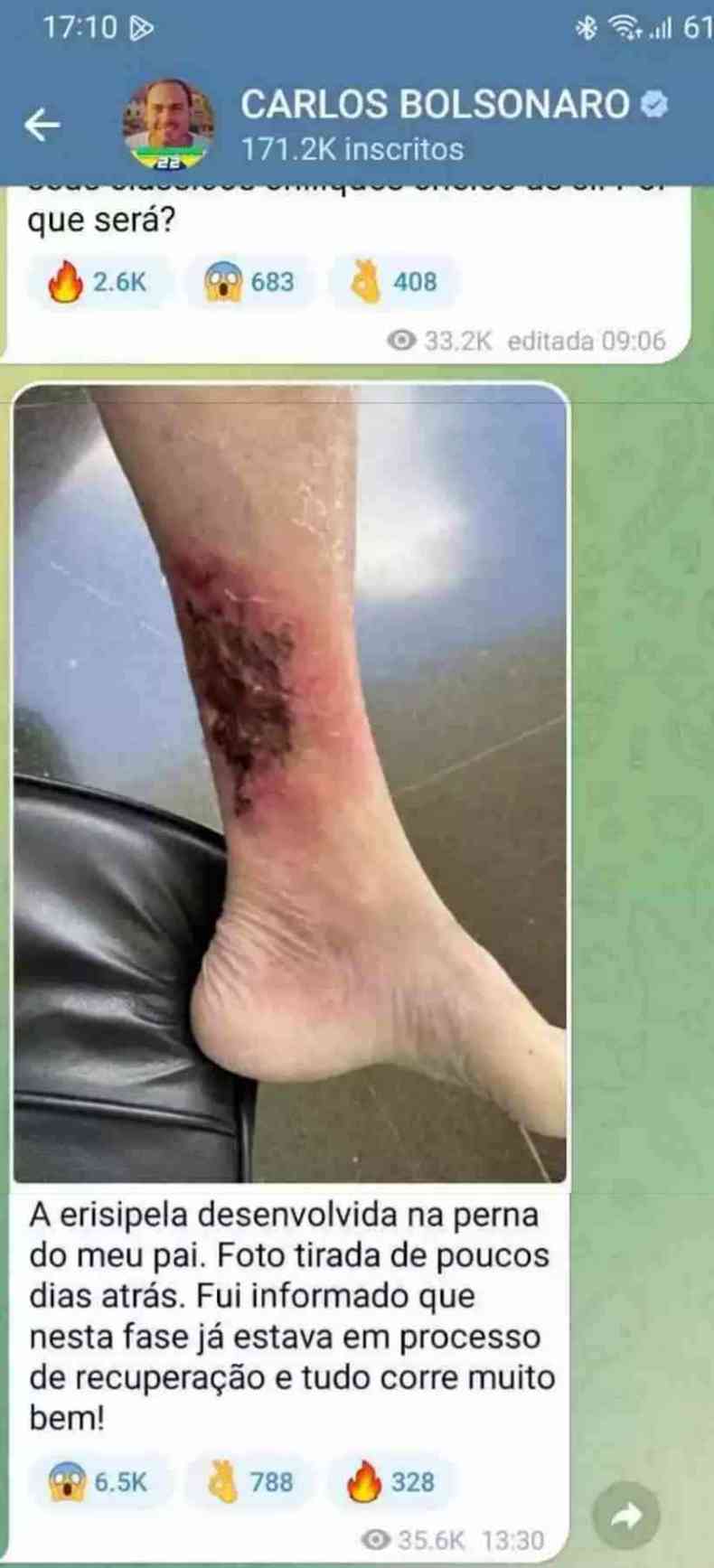 Post no Telegram de Carlos Bolsonaro mostrando ferida na perna de Jair Bolsonaro