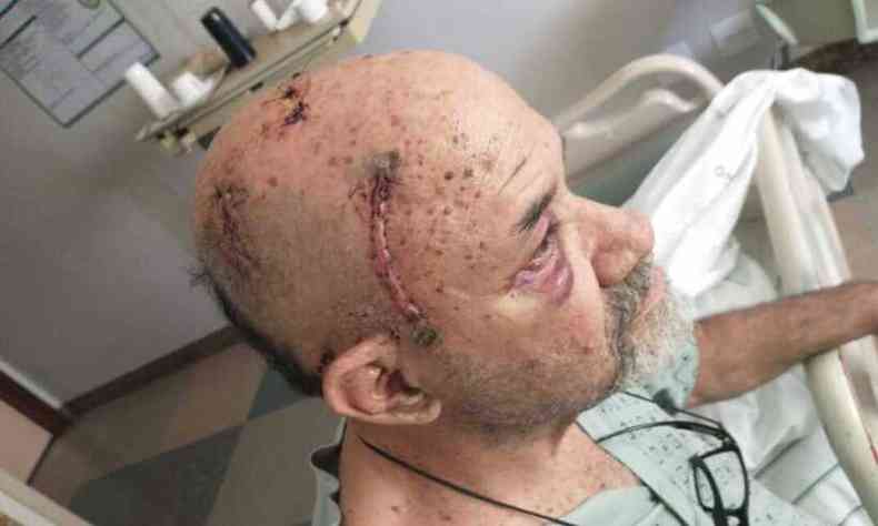Wesley Campos aps a cirurgia na cabea (foto: Arquivo Pessoal)
