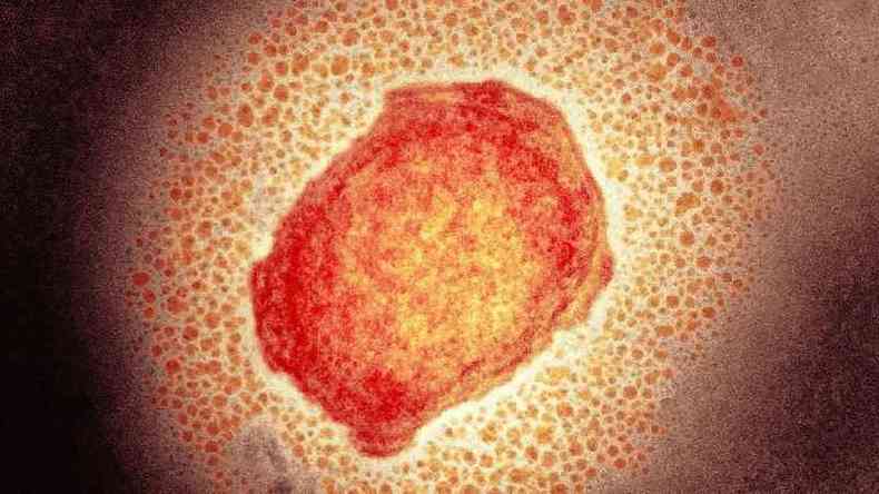 Partícula do vírus da varíola dos macacos, micrografia eletrônica de transmissão colorida 