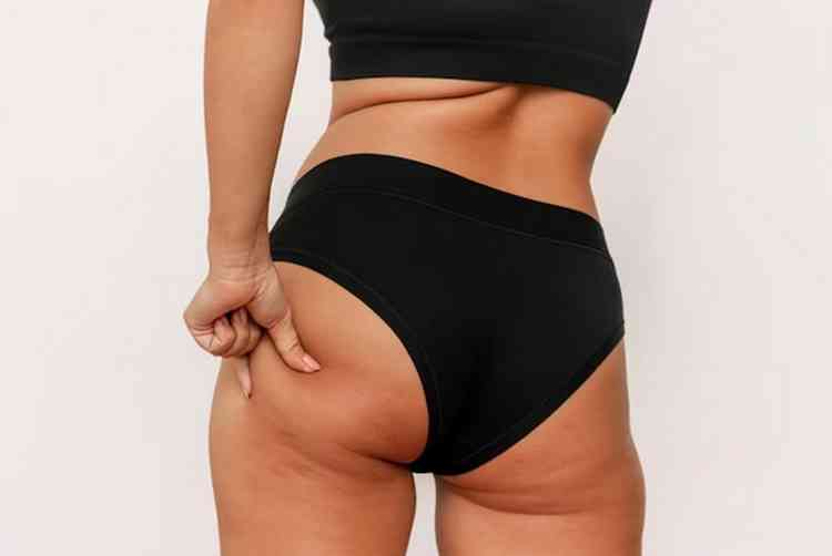 No existe um bumbum perfeito, o que existem so ideais de beleza que no precisam, necessariamente, serem seguidos, mas pacientes podem buscar suas melhores verses