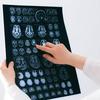 Creatina e saúde cerebral: benefícios para além da atividade física 