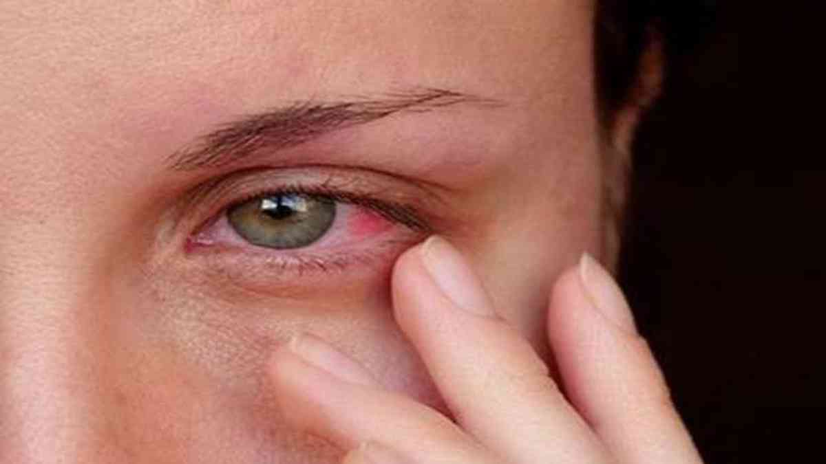 COVID-19: olhos podem sinalizar risco de infecção pelo vírus - Saúde -  Estado de Minas