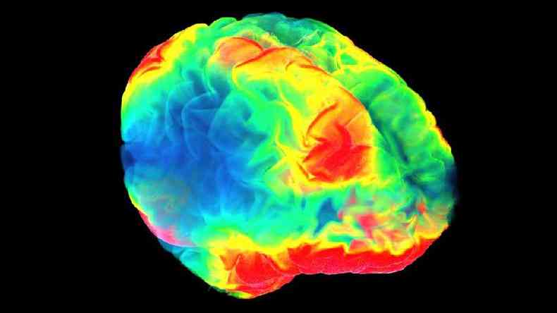 Ilustrao de um crebro com reas coloridas em azul, verde, amarelo e vermelho