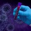 Cientistas brasileiros identificam antiviral para tratamento da COVID