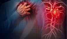 Enxaqueca é fator de risco para infarto e AVC, revela pesquisa