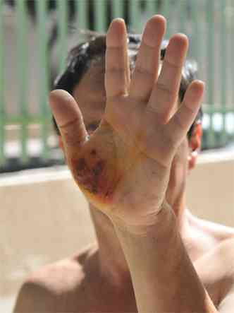 Homem mostra ferimentos provocados por ladres no Santa Tereza: 