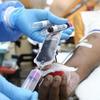 10 perguntas sobre diálise e cuidado renal: acabe com as dúvidas