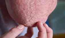 Dermatite: produto desenvolvido na UFJF ganha prmio nacional