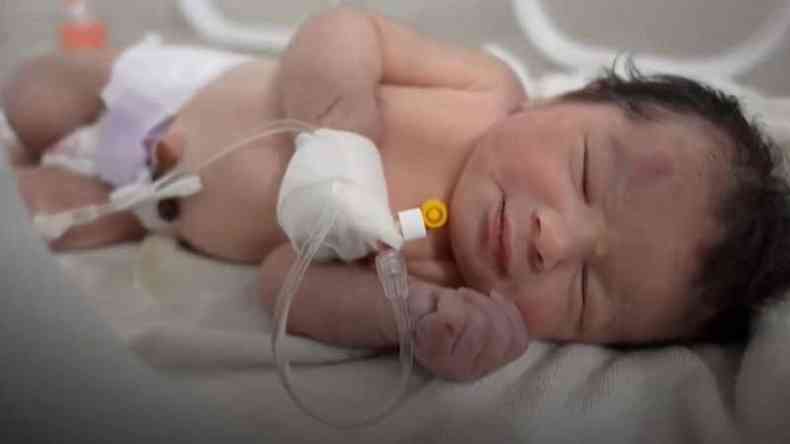 Afraa recm-nascida no hospital recebendo tratamento