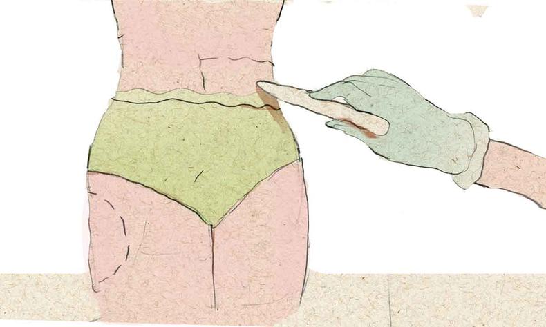 ilustrao mostra mulher de calcinhas e mo com luva fazendo marcas com caneta sobre o corpo dela