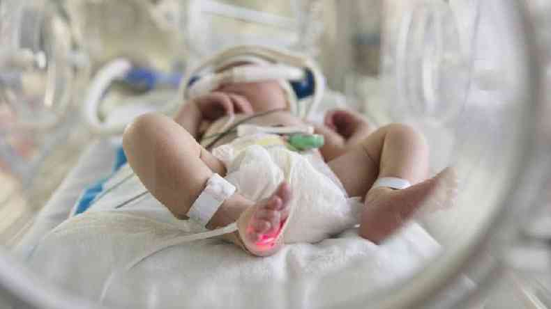 Desde incio da pandemia, 420 bebs (crianas com menos de 1 ano) morreram em decorrncia do novo coronavrus no Brasil, contra 45 nos Estados Unidos(foto: Getty Images)