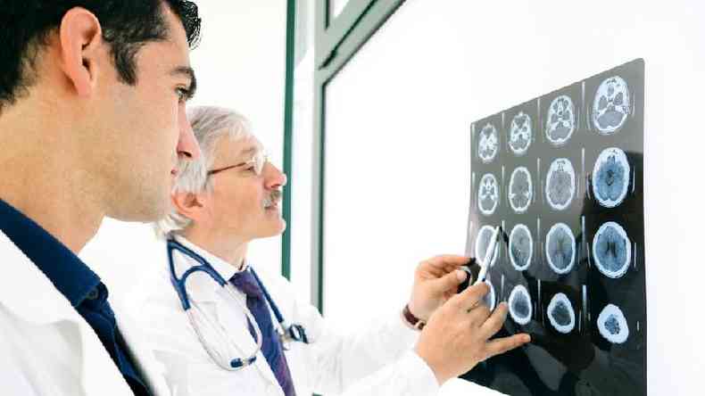 Médicos observam scanner cerebral