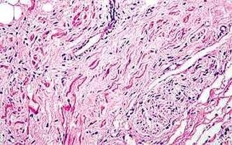 Tecido card�aco saud�vel: c�lulas-tronco adultas podem reparar danos(foto: NEPHRON/DIVULGA��O)