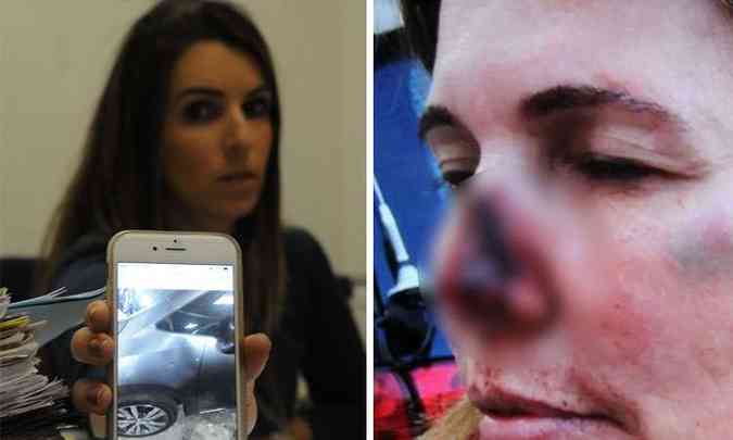 Delegada Cristiana Gambassi mostra foto do carro amassado da empresria Cristiana Viana, que foi agredida com socos no rosto - Vtima (D) ficou com hematomas no rosto(foto: JAIR AMARAL/EM/D.A PRESS)