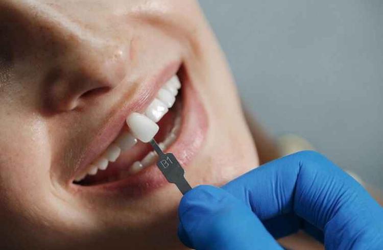 Reabilitao com implantes dentrios  indicada para pacientes que tiveram perdas dentrias e que no possuam comorbidades que interfiram no processo de osseointegrao