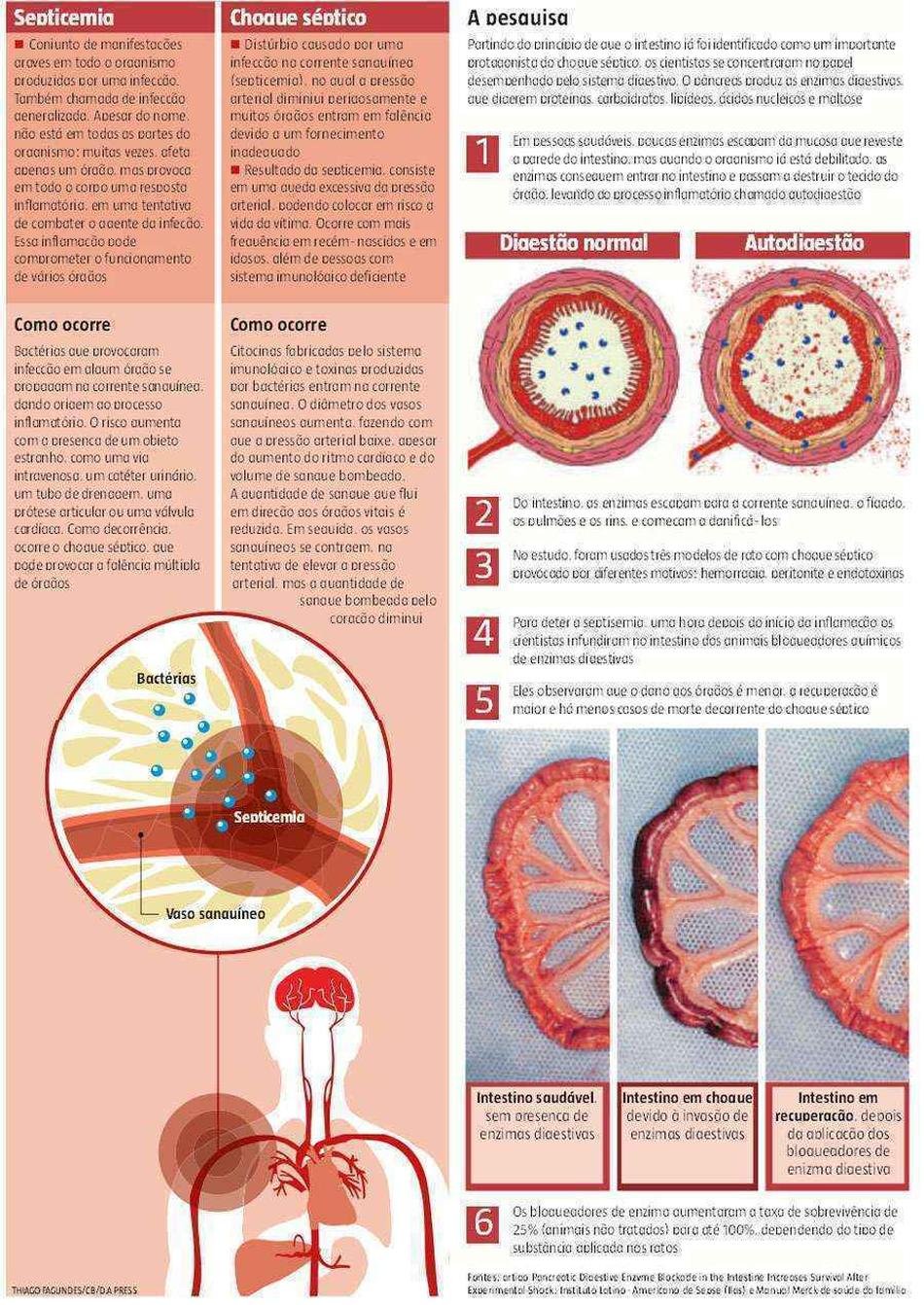 Infecção generalizada é causada por enzimas - Tecnologia - Estado de Minas