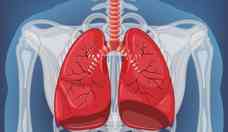 Cncer de pulmo: comprimido reduz pela metade risco de morte 