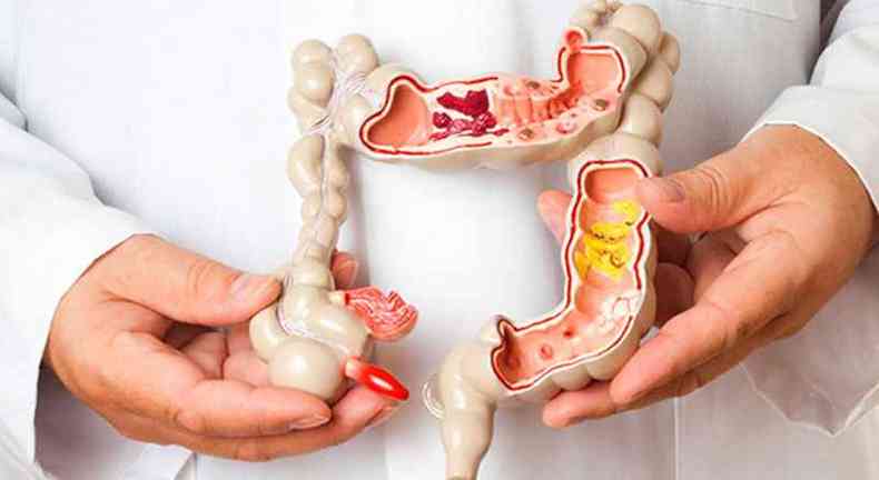 Imagem que mostra o intestino