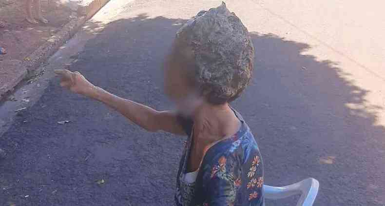 A mulher disse que o marido jogou cerca de trs litros de cola de sapateiro em sua cabea(foto: Reproduo/WhatsApp)
