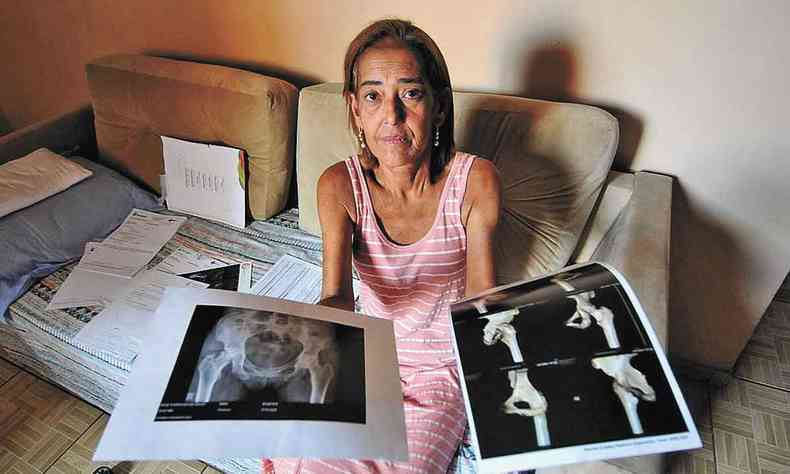 A aposentada Neide Rodrigues mostra os exames que constatam clinicamente a causa de sua dor. A espera pela cirurgia no quadril  angustiante