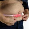  Abdominoplastia: 5 fatos que é preciso saber antes de fazer