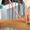 Doenças cerebrovasculares: pressão alta na gravidez é fator de risco