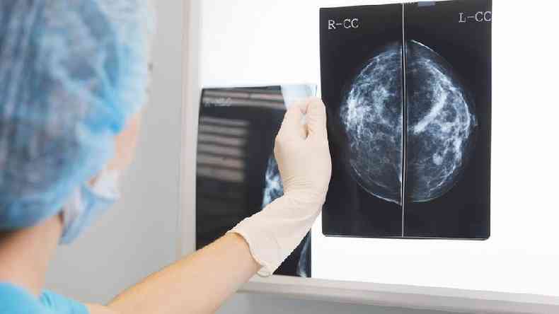 Mdico analisa mamografia