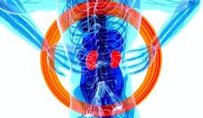 Terapia avanada traz mais qualidade de vida para pacientes renais   