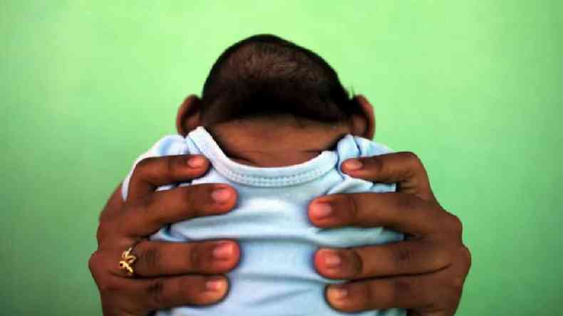 Beb nascido com microcefalia por conta de sndrome congnita do vrus zika, no Brasil, em 2016; especialistas temem que epidemias do tipo se tornem mais frequentes(foto: Reuters)