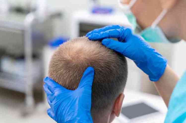 Cientista examinando couro cabeludo de homem