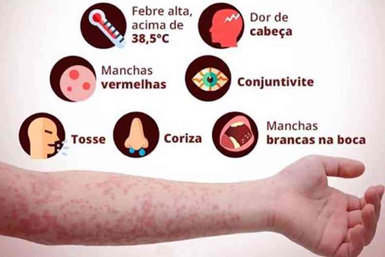 Principais sintomas do sarampo(foto: Ministério da Saúde)