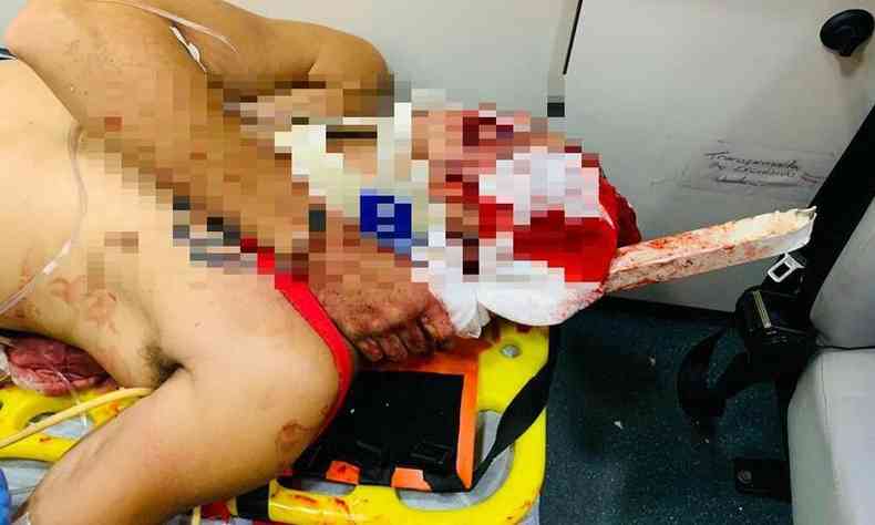 O motociclista ficou com uma barra de metal encravada no ombro esquerdo.(foto: Corpo de Bombeiros / Divulgao)