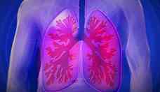 Cncer de pulmo provoca mais de 28 mil mortes no Brasil