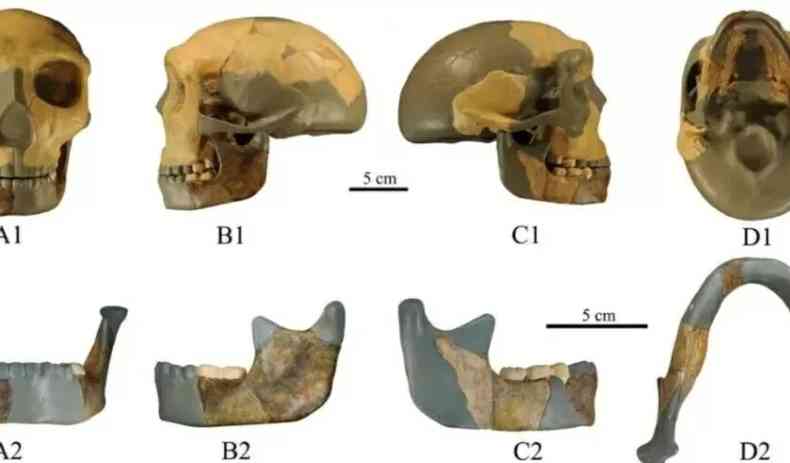 Como a vida moderna está mudando o esqueleto humano - BBC News Brasil