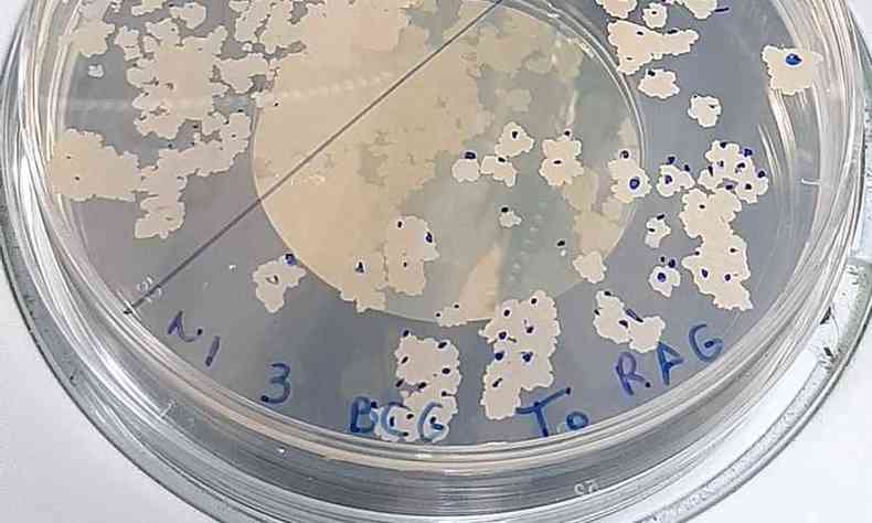 Bactria BCG  utilizada como base da vacina dupla que est sendo desenvolvida para combater o coronavrus e a tuberculose(foto: Divulgao/Prof. Srgio Costa)