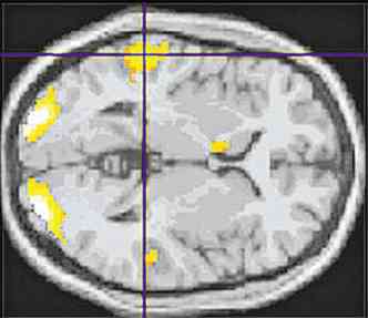 Estudo da mente foi transformado por tcnicas que mostram a ativao cerebral(foto: Adam Zeman)