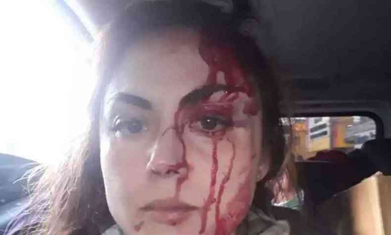 Foto de redes sociais mostra cabeça da procuradora sangrando. Sangue escorre pelo rosto