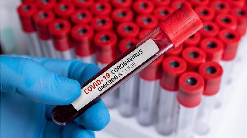 Variante ômicron do coronavírus foi detectada pela primeira vez na África do Sul(foto: Getty Images) Tubo de ensaio com etiqueta da ômicron