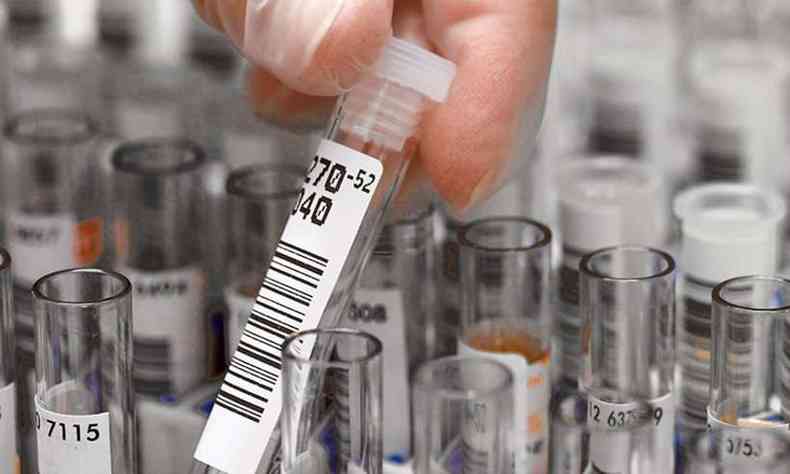 Empresa farmacutica teve a liberao concedida para realizar novo teste sorolgico (foto: Divulgao/ Roche)