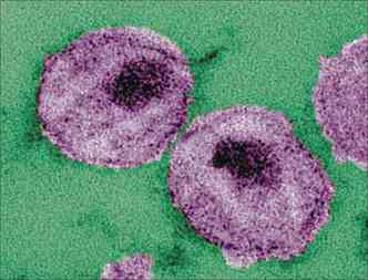 HIV em imagem microscpica: compreenso de seu funcionamento  crucial para frear a ao do vrus(foto: Centers for Disease Control and Prevention/Reuters)