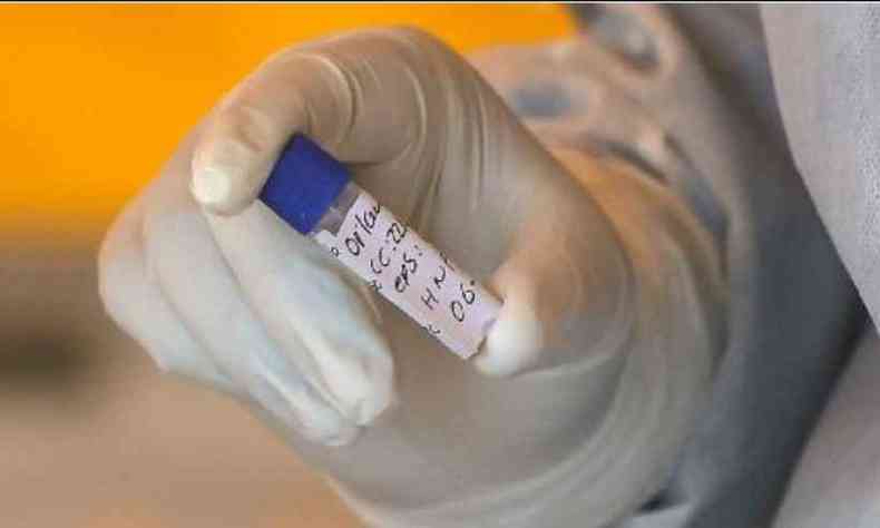 Amostra de teste para detectar infeco pelo novo coronavrus(foto: JUAN BARRETO/AFP)