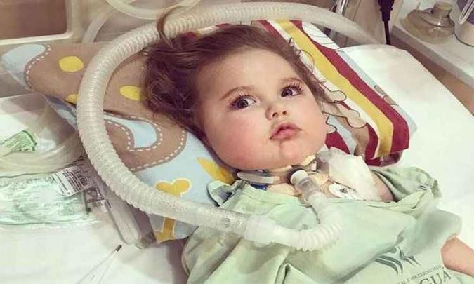 O bebê Jonatas, no primeiro dia de tratamento com medicamento importado dos EUA(foto: Facebook/Reprodução ) O bebê Jonatas, no primeiro dia de tratamento com medicamento importado dos EUA(foto: Facebook/Reprodução )
