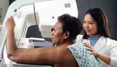 ndice de realizao de mamografias no Brasil  abaixo do recomendado