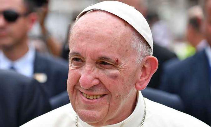 Papa Francisco termina visita à Colômbia com ferimento no olho após queda(foto: ALBERTO PIZZOLI/AFP) Papa Francisco termina visita à Colômbia com ferimento no olho após queda(foto: ALBERTO PIZZOLI/AFP)