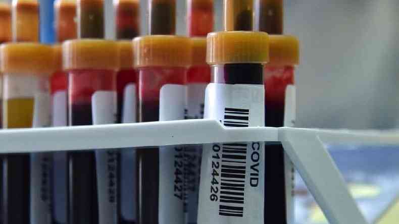 Vials of blood for Covid testing